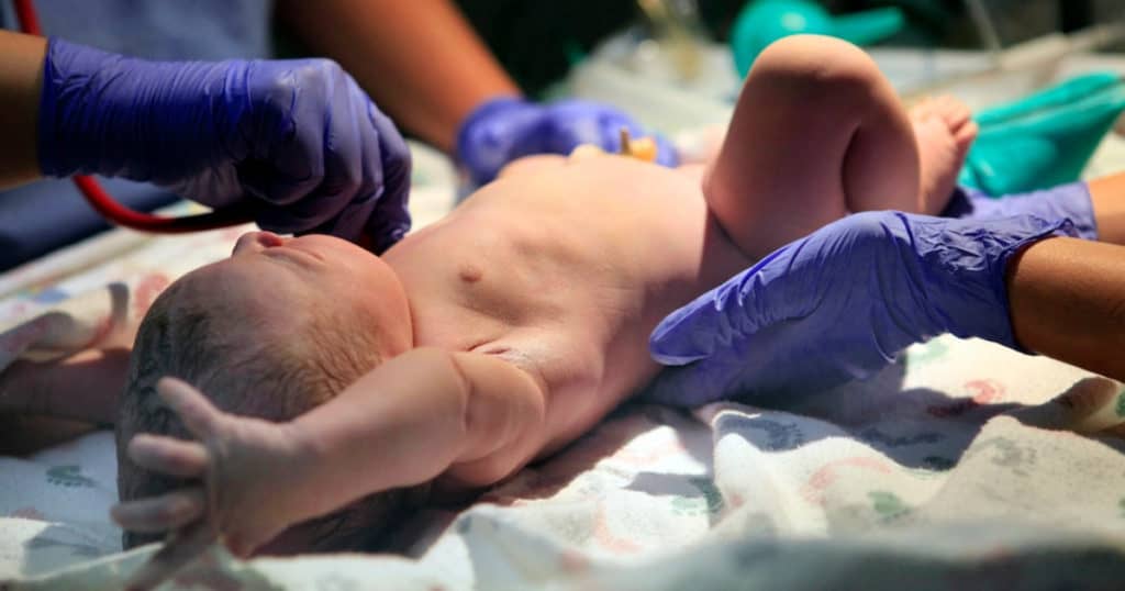 doula support for c-sections