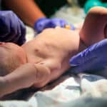 doula support for c-sections