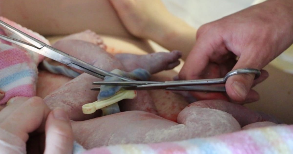 delayed-cord-clamping