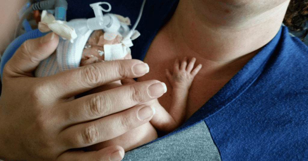 Tiny baby in the NICU resting on Mom