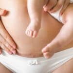 Mom with c-section scar holding baby, c-section recovery
