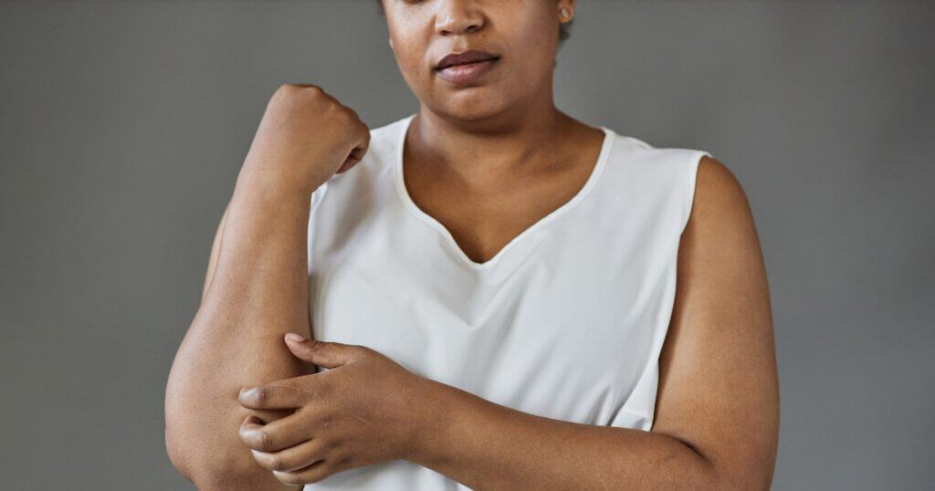 cholestasis in pregnancy, lady itching