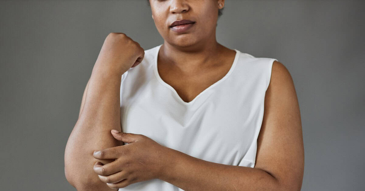 cholestasis in pregnancy, lady itching