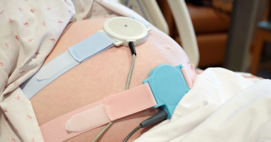 fetal monitoring on a pregnant mom belly