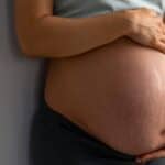 stretch marks during pregnancy