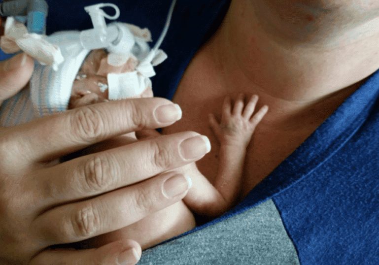 Tiny baby in the NICU resting on Mom