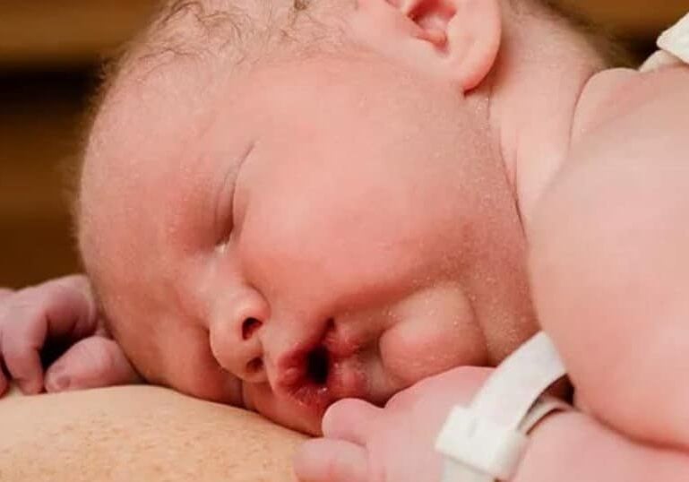 Breastfeeding, Skin to Skin
