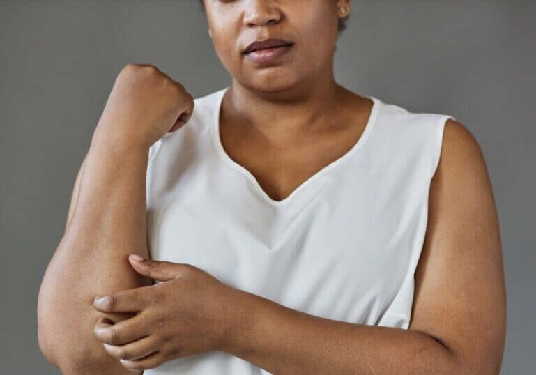 cholestasis in pregnancy, lady itching