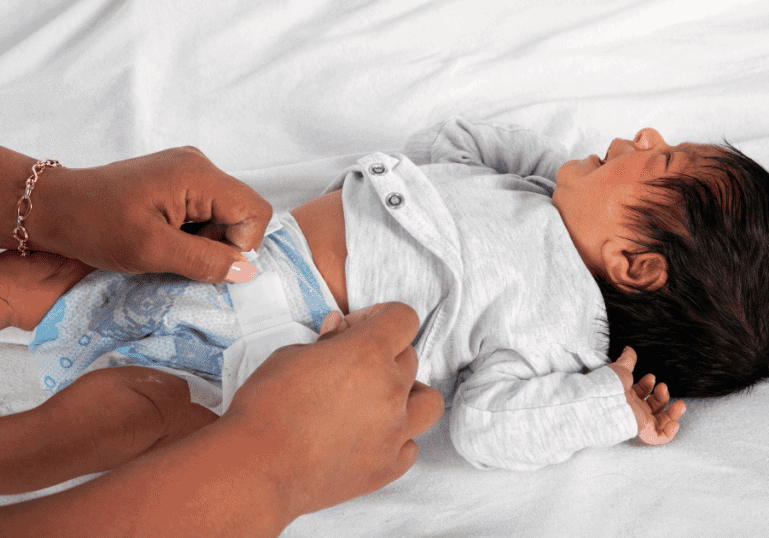 A mom changing newborn poop diaper