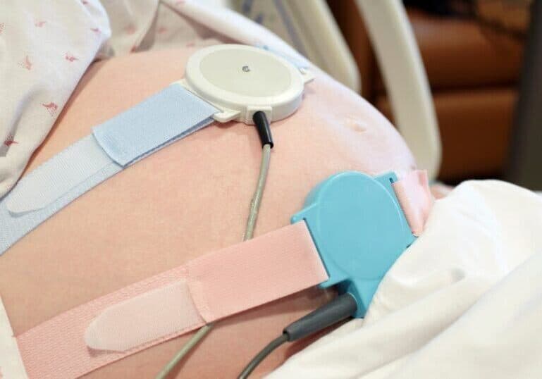 fetal monitoring on a pregnant mom belly