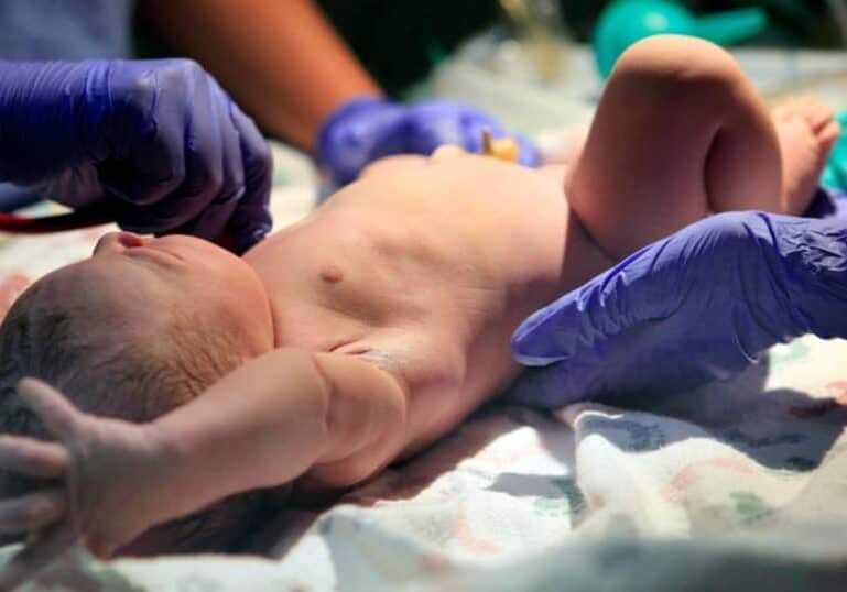 doula support for c-sections