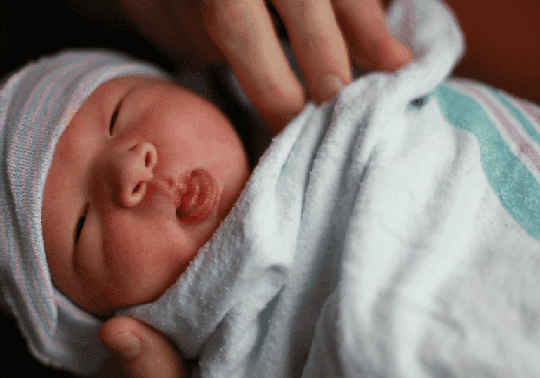 tongue-ties-and-breastfeeding